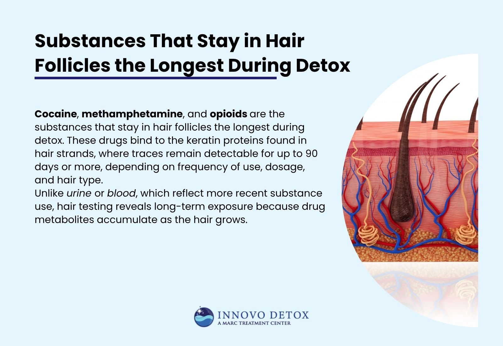 Substances That Stay in Hair Follicles the Longest During Detox